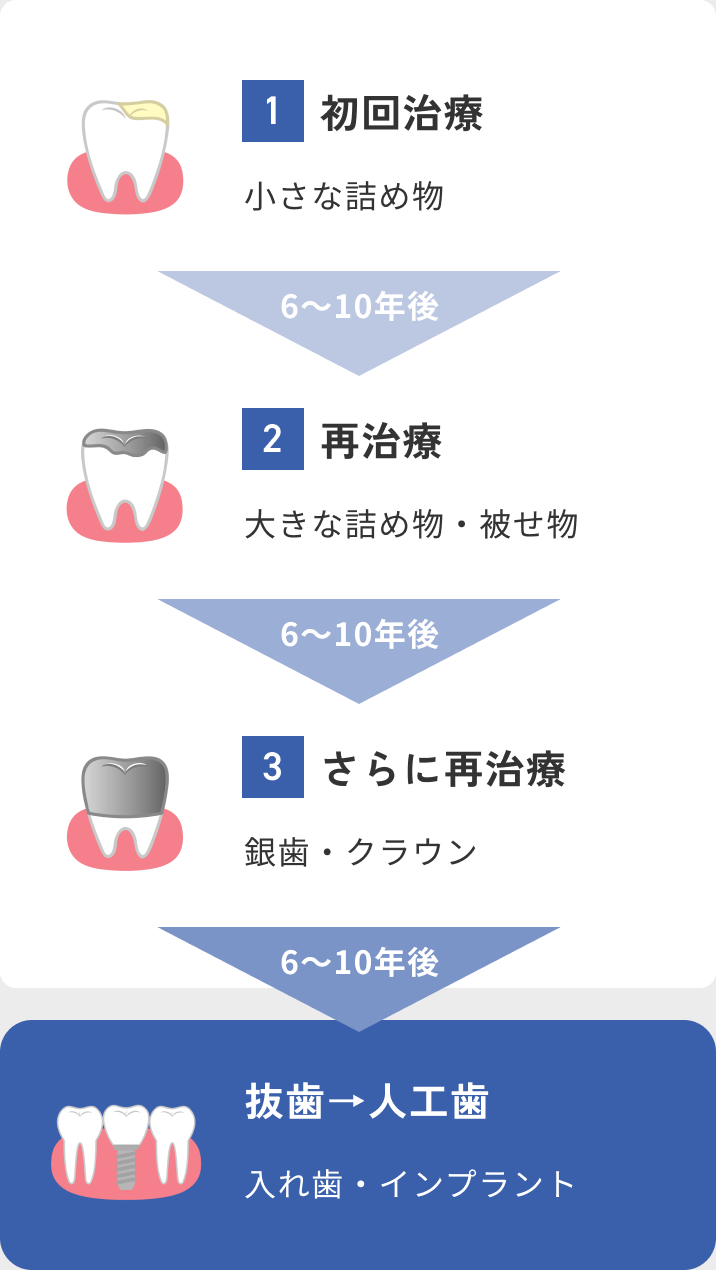 初回治療（小さな詰め物）→6〜10年後→再治療（大きな詰め物・被せ物）→6〜10年後→さらに再治療（銀歯・クラウン）→6〜10年後→抜歯・人工歯（入れ歯・インプラント）