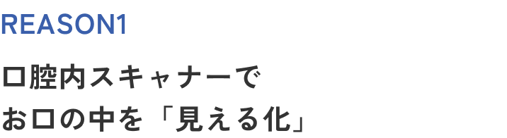 REASON1 口腔内スキャナーでお口の中を「見える化」