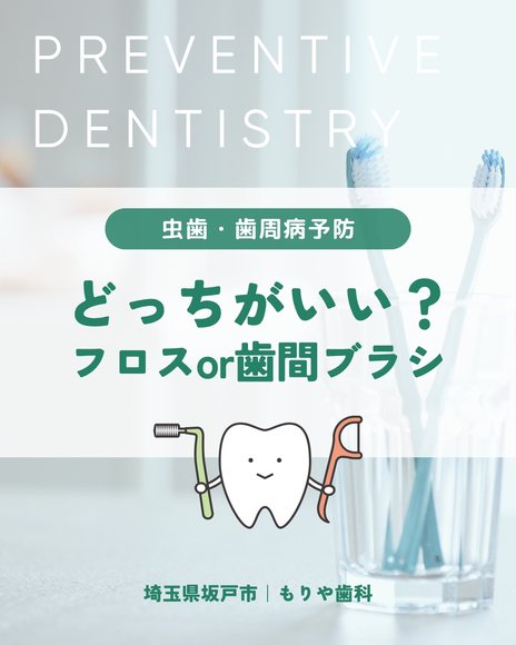 どっちがいい？フロスor歯間ブラシ｜虫歯・歯周病予防