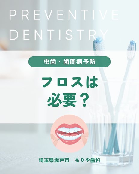 フロスは必要？｜虫歯・歯周病予防