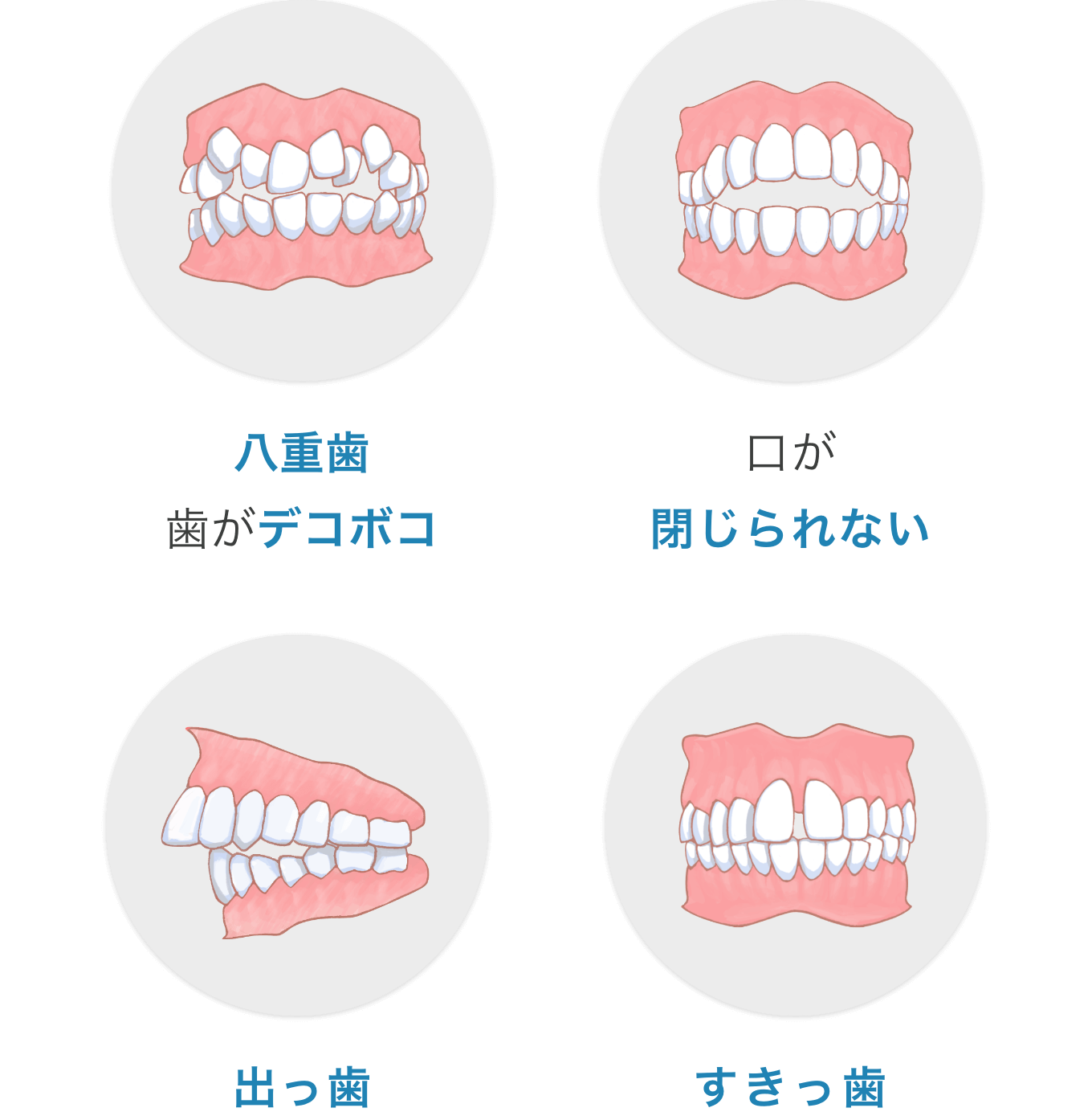 八重歯/口が閉じられない/出っ歯/すきっ歯